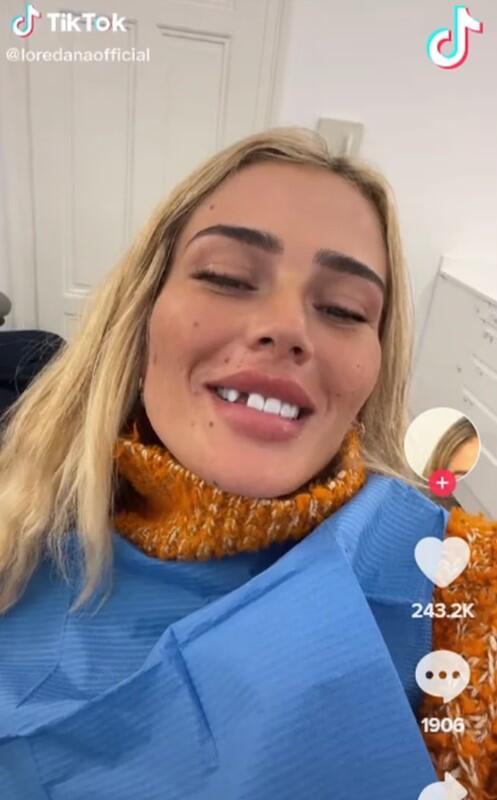 Im Herbst 22 zeigte sich Rapperin Loredana Zefi plötzlich mit Zahnlücke