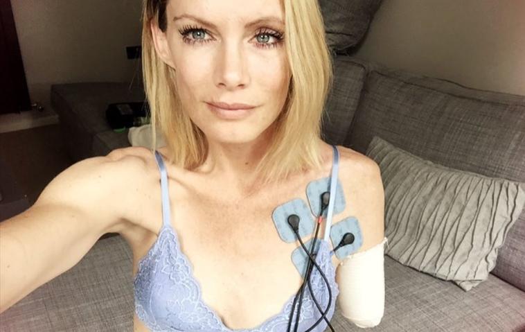 Stuntfrau Olivia Jackson verlor bei einem "Resident Evil"-Setunfall ihren Arm